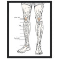 Fell Runner Body Horror Humour Framed Print Wall Art Ready to Hang UK Framed Art Print — detail view | Wild Thread Co