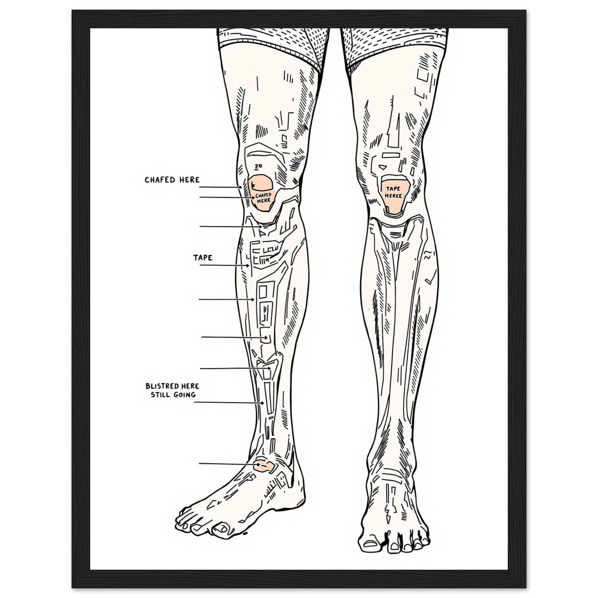 Fell Runner Body Horror Humour Framed Print Wall Art Ready to Hang UK Framed Art Print — detail view | Wild Thread Co