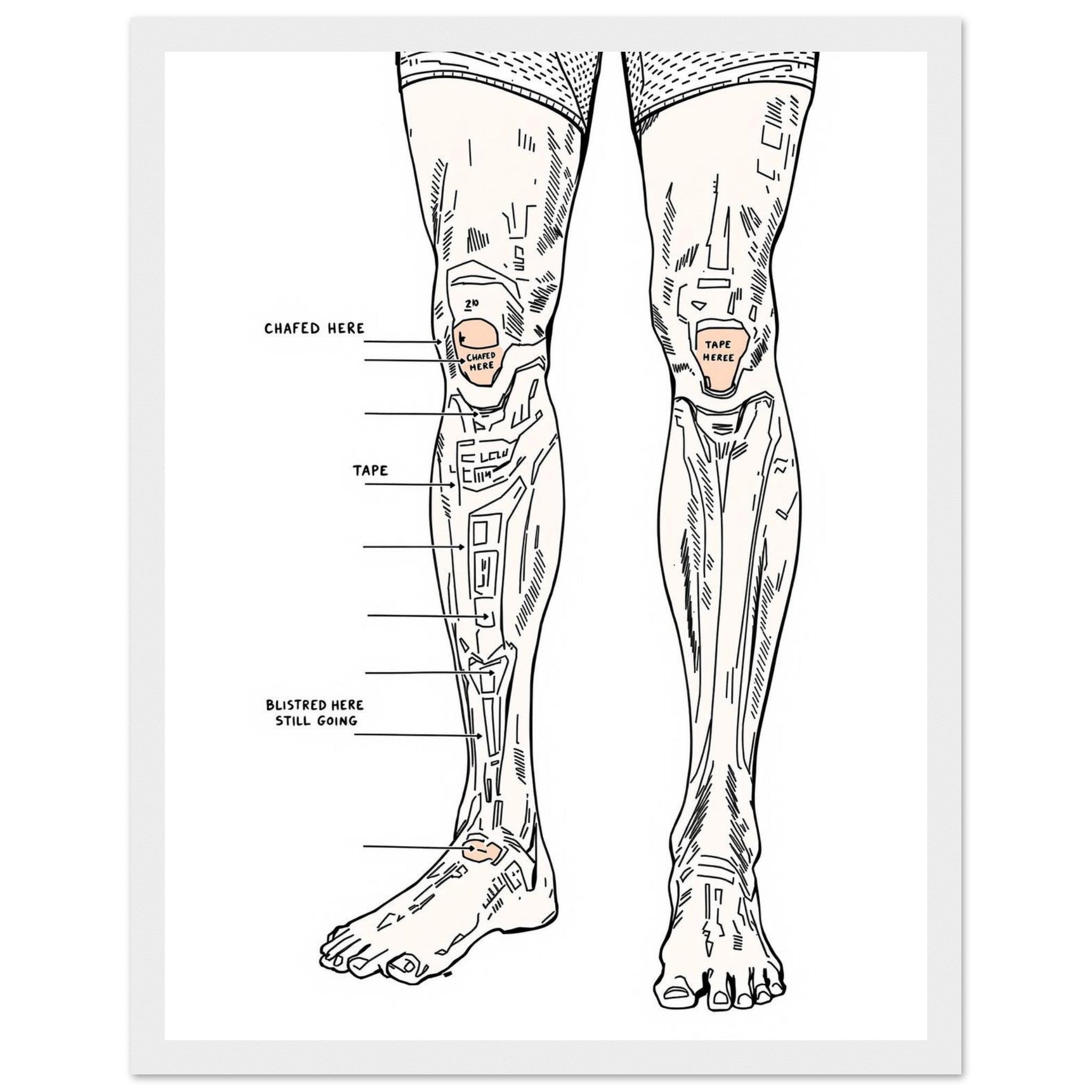 Fell Runner Body Horror Humour Framed Print Wall Art Ready to Hang UK Framed Art Print — detail view | Wild Thread Co