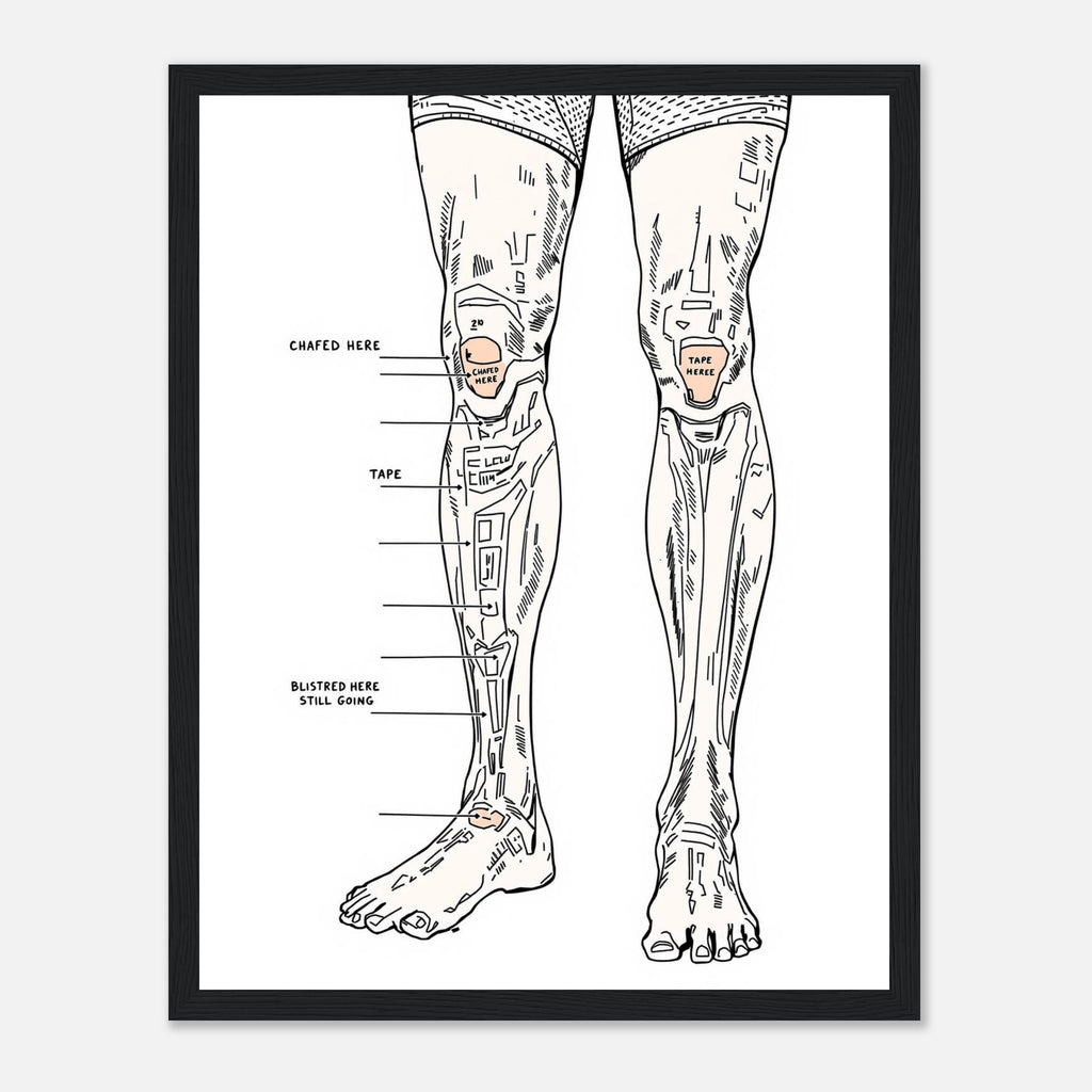 Fell Runner Body Horror Humour Framed Print Wall Art Ready to Hang UK Framed Art Print — detail view | Wild Thread Co
