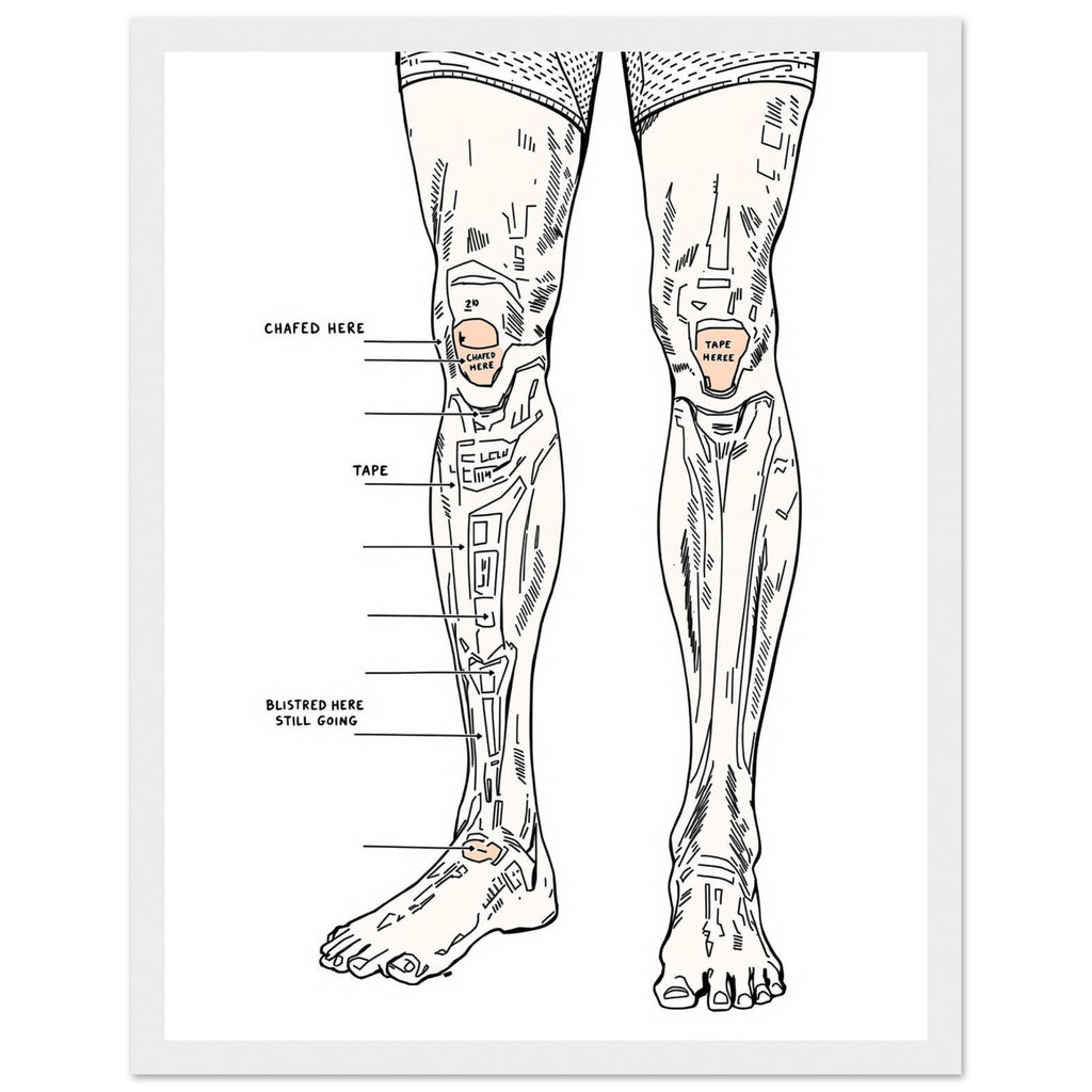 Fell Runner Body Horror Humour Framed Print Wall Art Ready to Hang UK Framed Art Print — detail view | Wild Thread Co