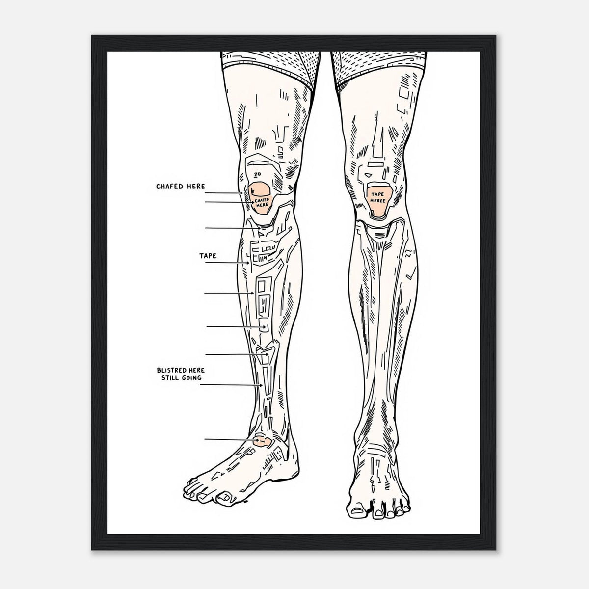 Fell Runner Body Horror Humour Framed Print Wall Art Ready to Hang UK - Wild Thread Co